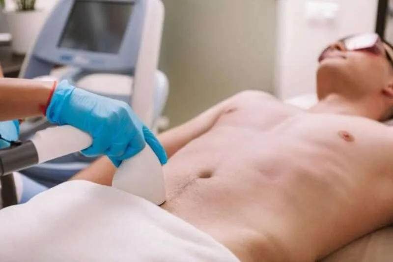 Ngoài cạo, nam giới có thể cân nhắc kem tẩy lông, wax hoặc triệt lông công nghệ cao, nhưng mỗi phương pháp đều có ưu và nhược điểm riêng.